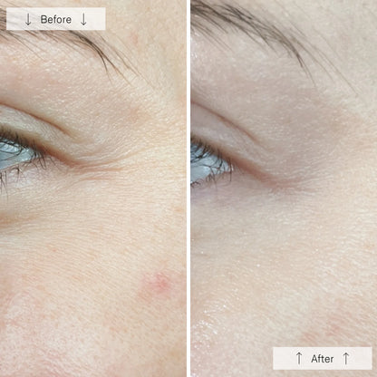 Omnilux Contour Face Near Infrared + LED